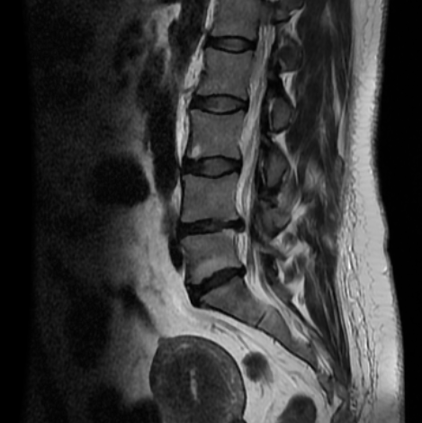badania przy bólu lędźwi - fizjoterapeuta omawia tk, mri, rtg, usg