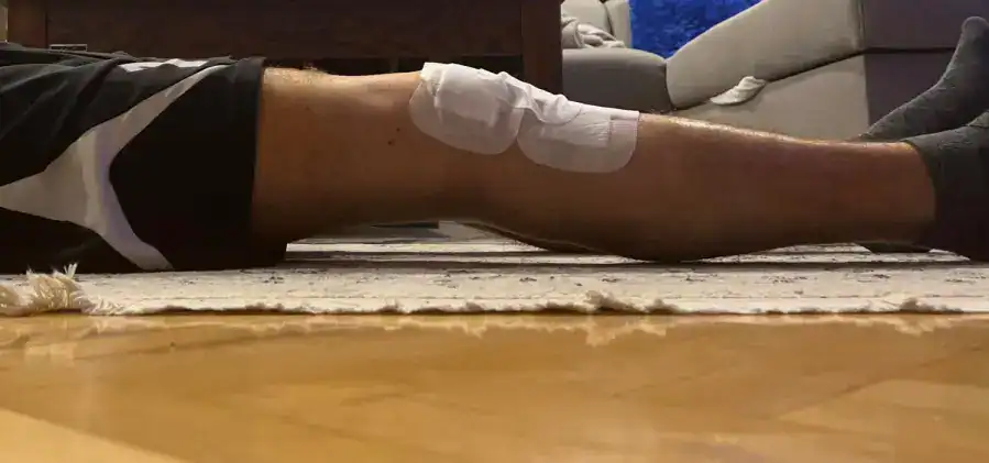 kiedy zacząć rehabilitację po operacji