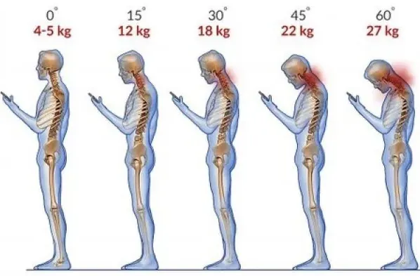 jak zmniejszyć ból pleców komórka szyja