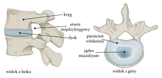 wypadnięty dysk rehabilitacja katowice