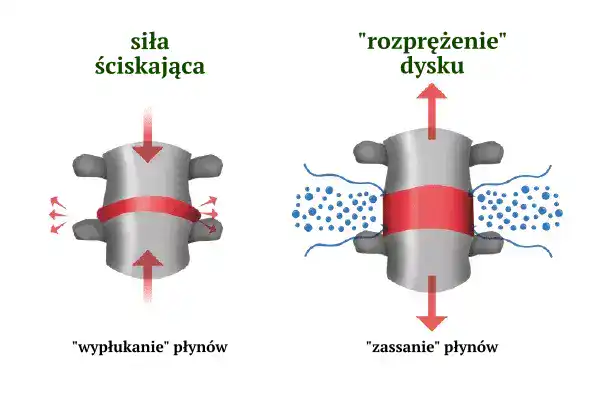 aktywność fizyczna a leczenie dyskopatii