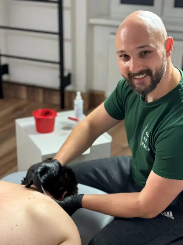 fizjoterapia-katowice-suche-igłowanie