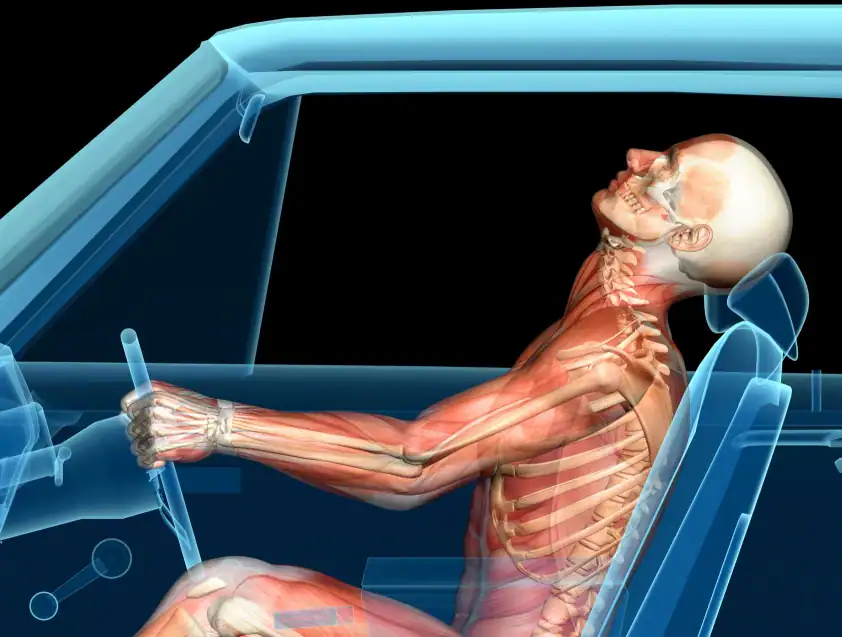 uraz szyi po wypadku samochodowym whiplash